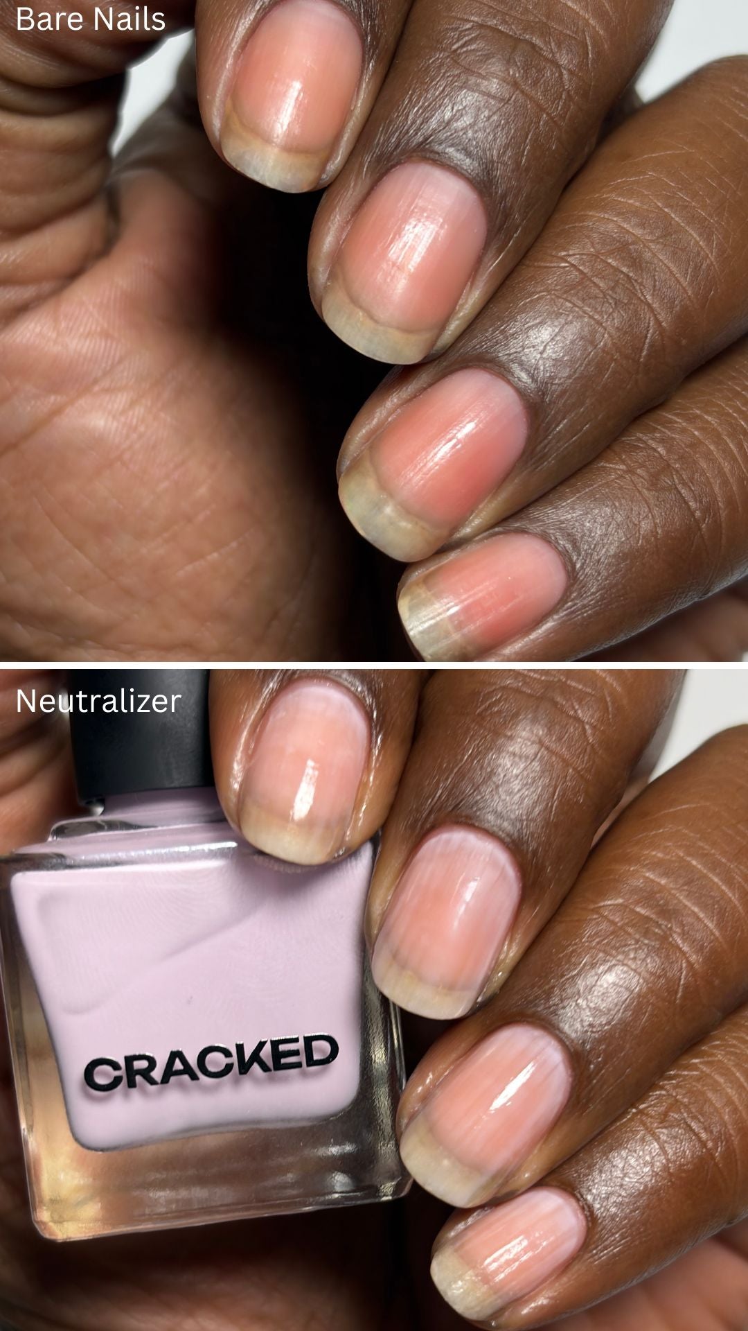 Neutralizer