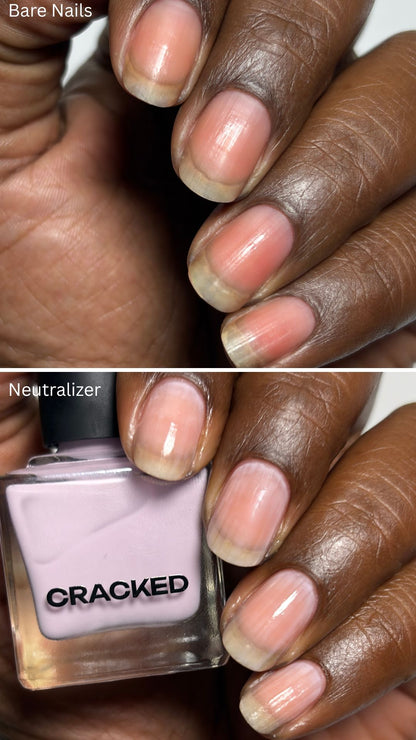 Neutralizer
